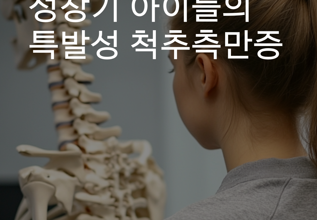 성장기 아이들의 특발성 척추측만증